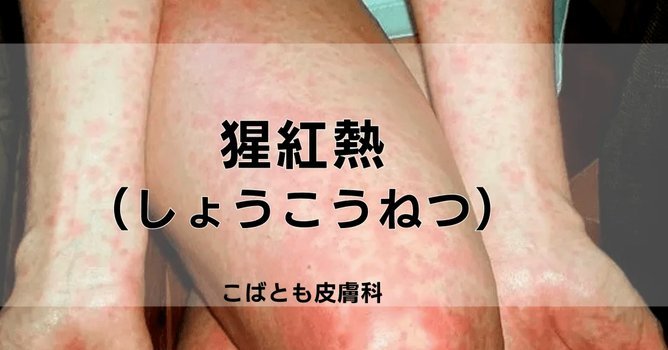 急用钱花呗如何套现
